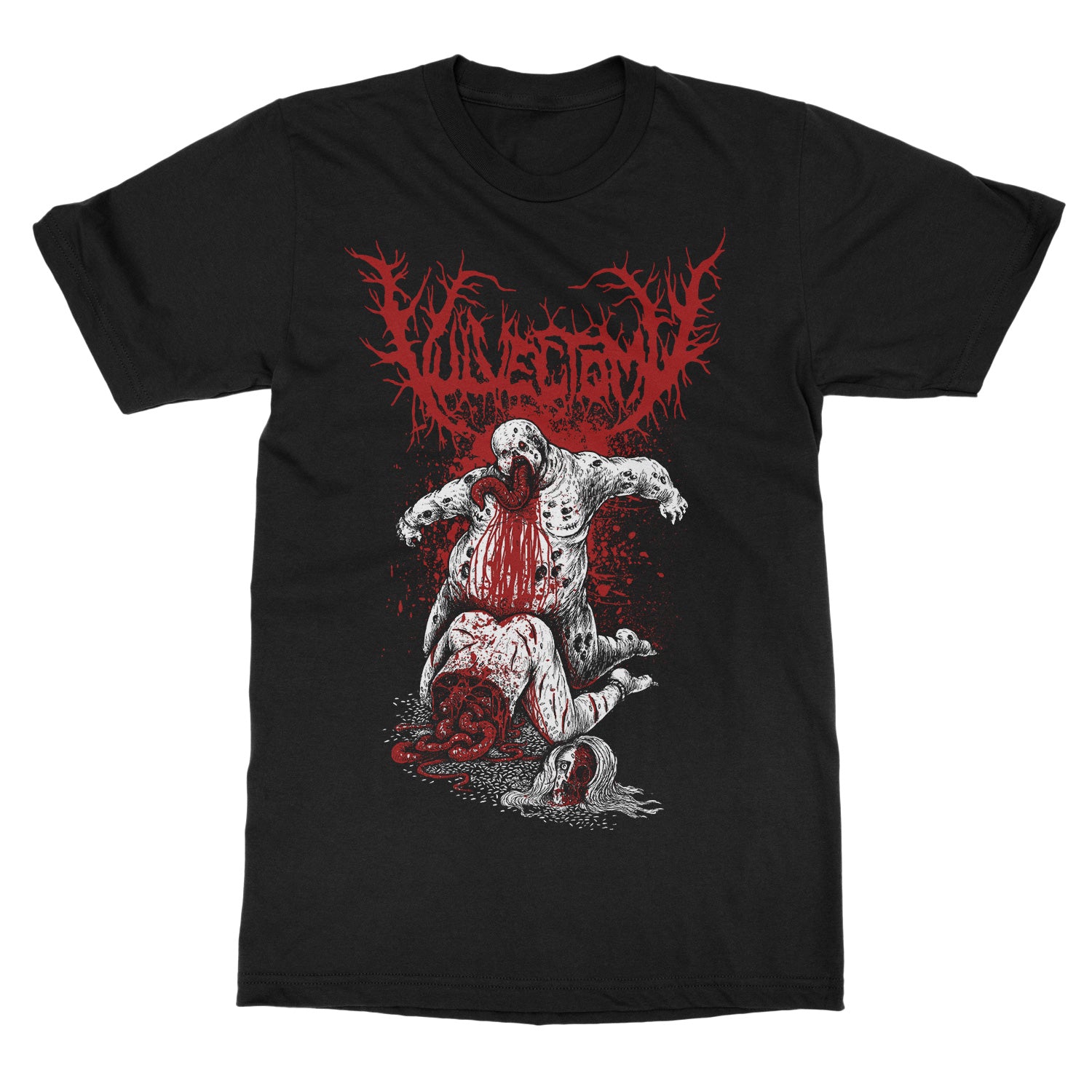 Vulvectomy Are You A Sick Fuck T-Shirt - Image 2